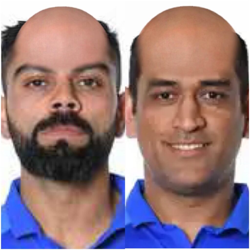 Indian Famous Cricketer If They Go Bald Look Like watch Here