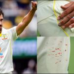 Speedster Mitchell Starc ruled out of final test against South Africa due to injury